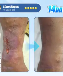 ADFIRE® Diabetic Skin Revolution – 6-IN-1 Clinical Solution