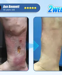 ADFIRE® Diabetic Skin Revolution – 6-IN-1 Clinical Solution