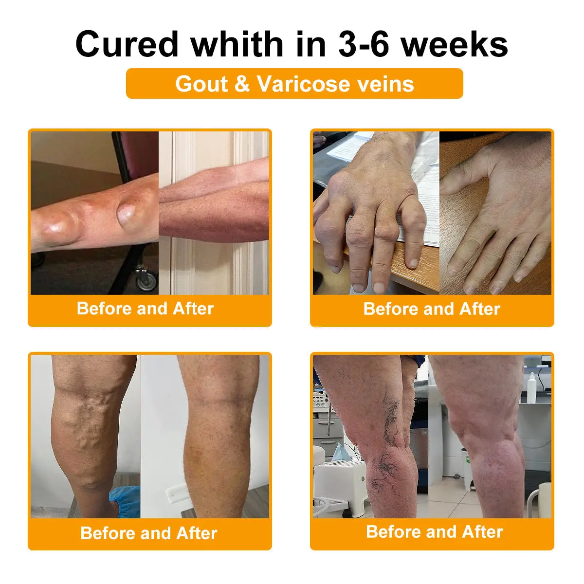 ADNOON™ Botulinum Toxin & Bee Venom Pain-Relief Bone Healing Cream