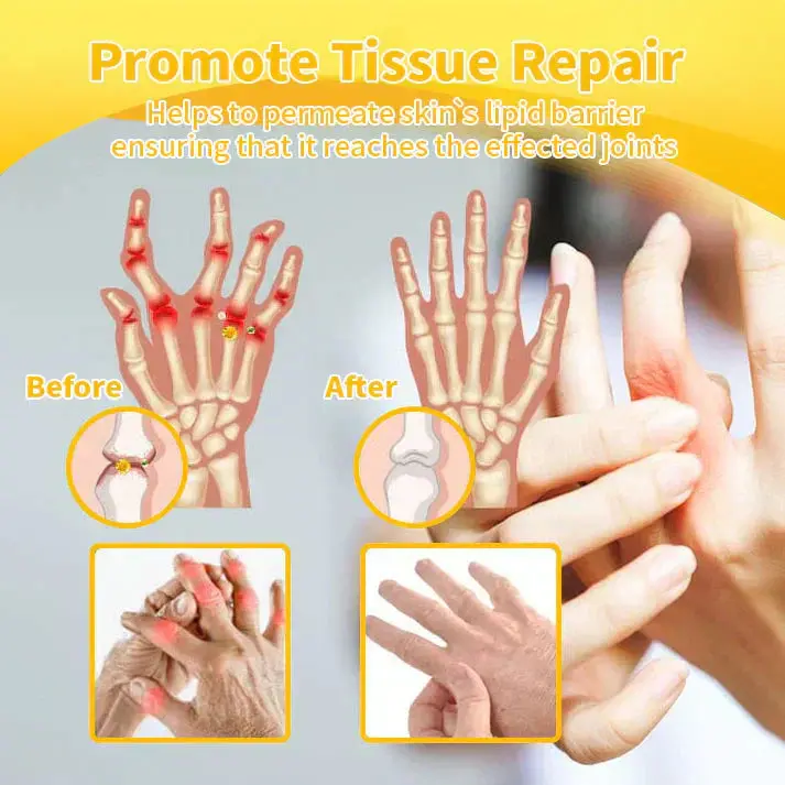 ADNOON® 💧Magnesium Oil & Bee Venom Joint Healing Spray