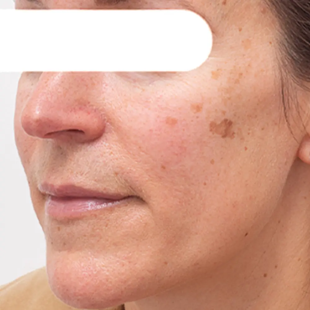 AQA™ Herbal Spots Peel-Off Facial Mask