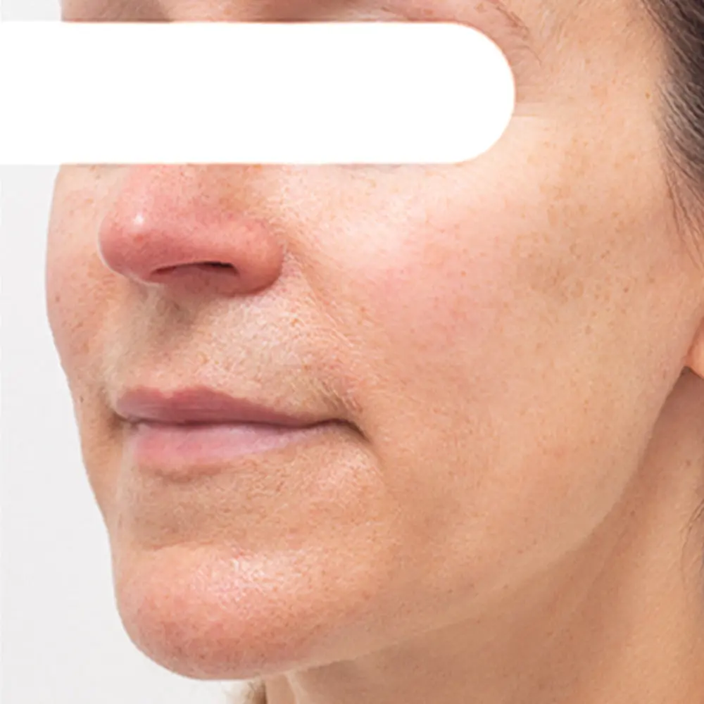 AQA™ Herbal Spots Peel-Off Facial Mask