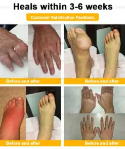 Daasry™ Botulinum Toxin & Bee Venom Pain-Relief Bone Healing Cream