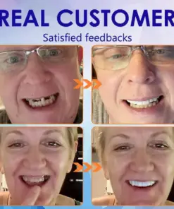 DentureGlow™ –🦷Get a Perfect Smile Fast!🦷 (⏰30-Min Flash Sale Ends Soon!⏰)