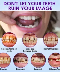 GripNFit™ Silicone Denture Set