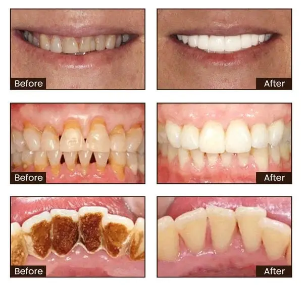 JEREMYTIS™ Ultra Whitening Mint Toothpaste