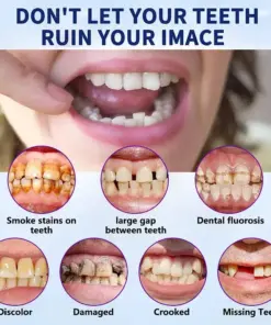 NESLEMY®-🦷Advanced Customized Full Denture Set