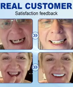 Nurbini® Advanced Customized Full Denture Set
