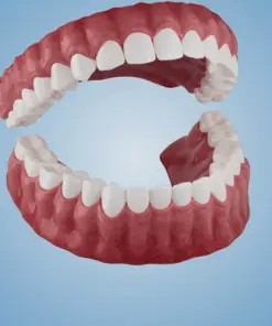 Nurbini® Advanced Customized Full Denture Set