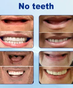 Nurbini® Advanced Customized Full Denture Set