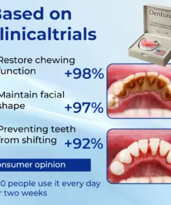 Nurbini® Advanced Customized Full Denture Set