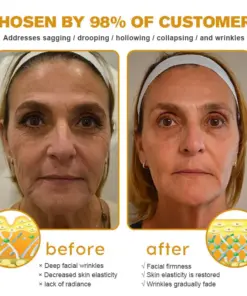 STDEI® APIS VENENUMREPAIR BALM