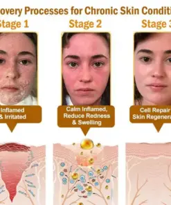 STDEI® APIS VENENUMREPAIR BALM