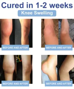 TAILEDEN™ Official Store: Magnesium Pain Healing Bone Cream
