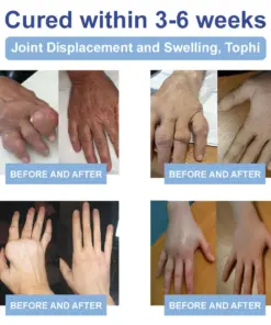 TAILEDEN™ Official Store: Magnesium Pain Healing Bone Cream