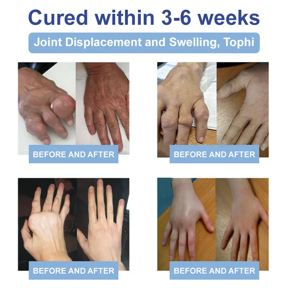 TAILEDEN™ Official Store: Magnesium Pain Healing Bone Cream