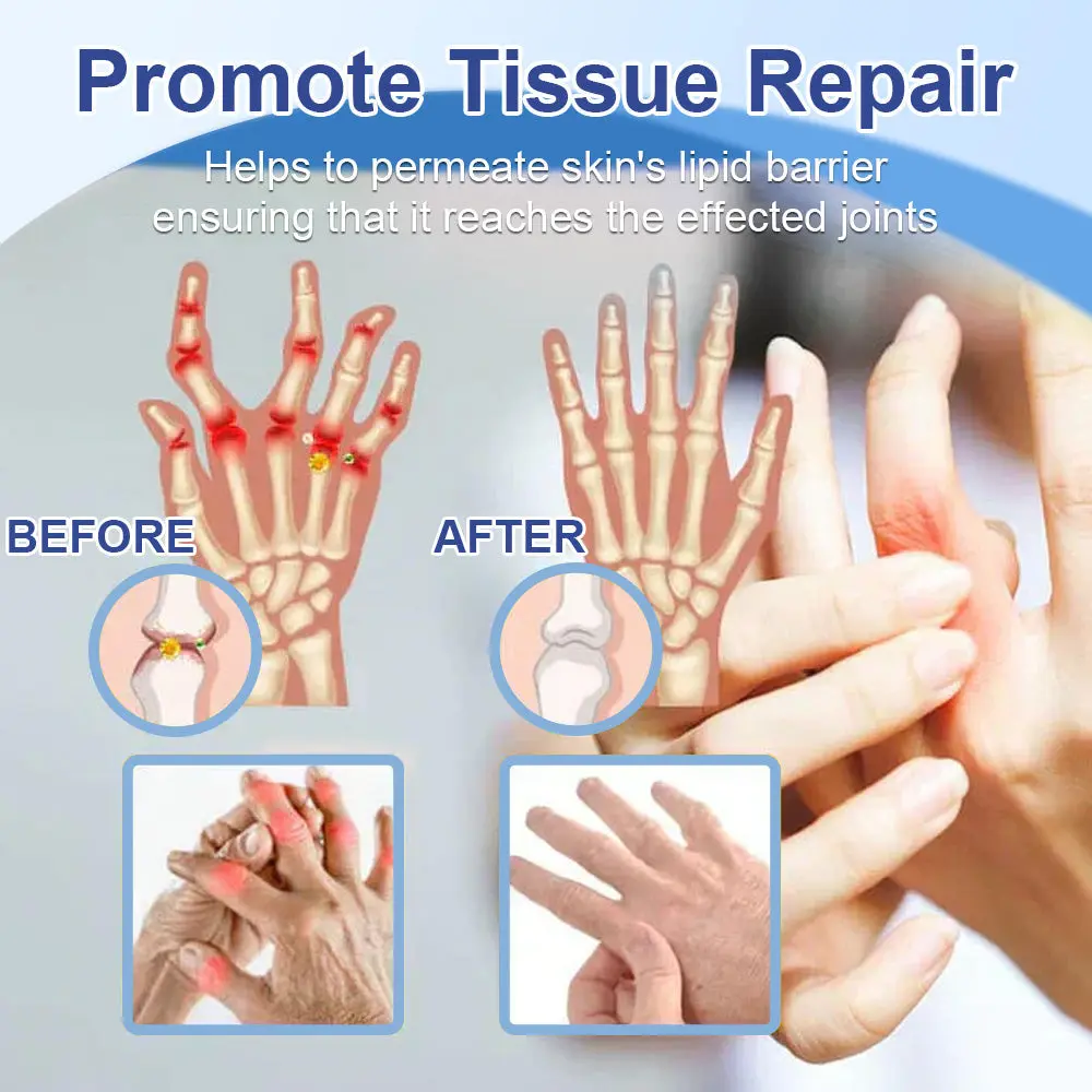 TAILEDEN™ Official Store: Magnesium Pain Healing Bone Cream