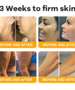 VLSVLS® Bee Venom Skin Restoration Cream