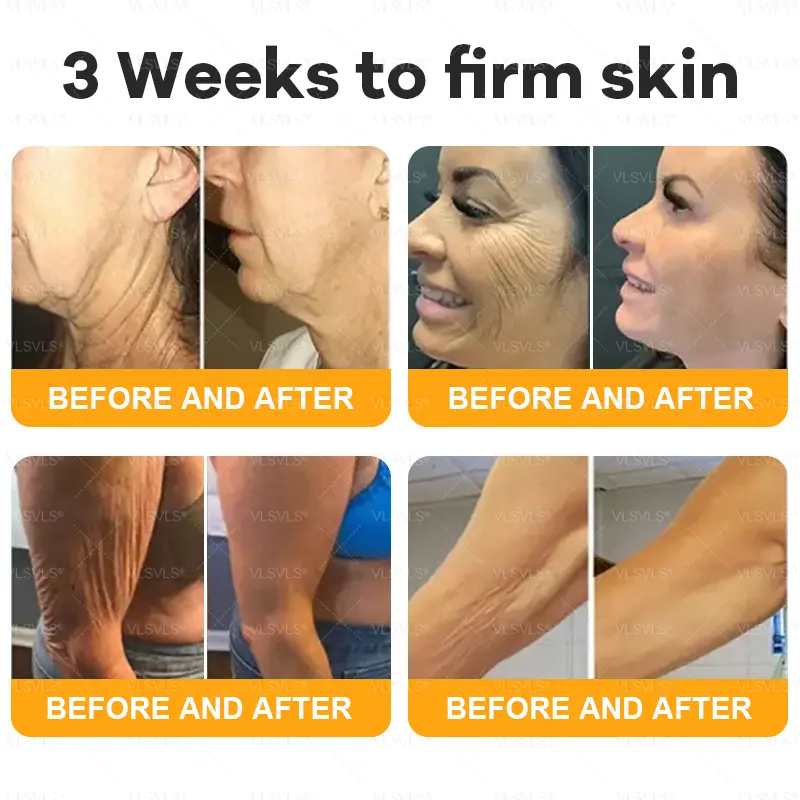 VLSVLS® Bee Venom Skin Restoration Cream