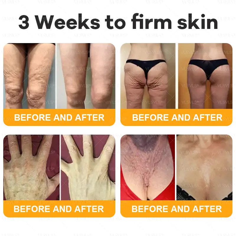 VLSVLS® Bee Venom Skin Restoration Cream