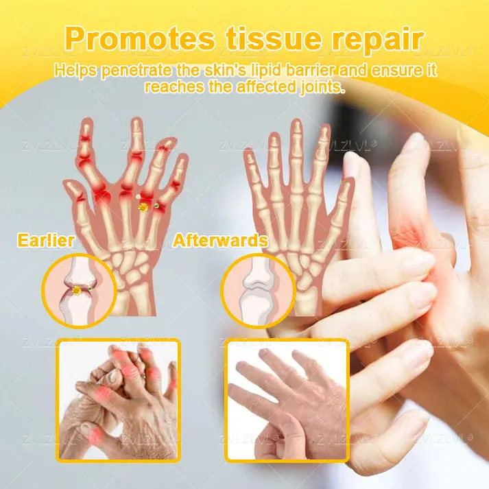 ZVLZVL® Bee Venom Pain-Relief Bone Healing Cream