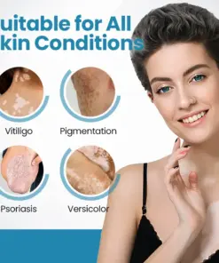 Nurbini® DermaBeam Vitiligo Therapy device