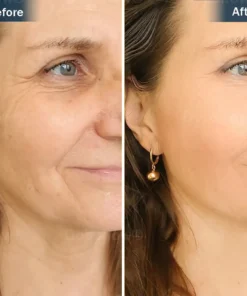 Nurbini® Sleeping V-Face Beauty Device